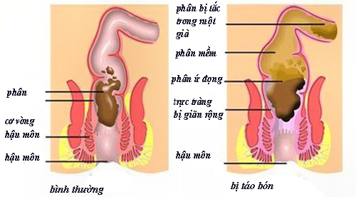 http://www.quangninhcdc.vn/images/users/images/%E1%BA%A2nh%20st.png