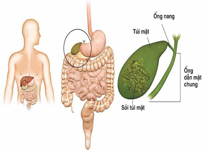 https://hongngochospital.vn/wp-content/uploads/2020/05/soi-tui-mat.jpg